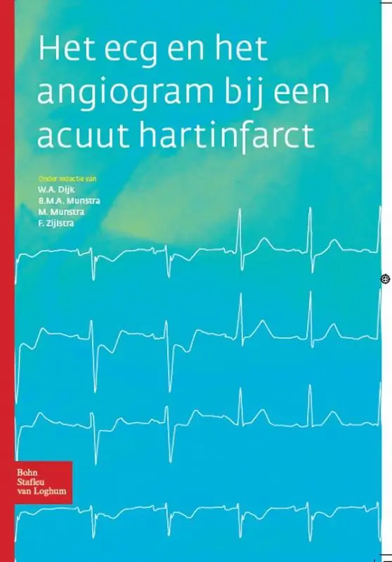 HET ECG EN HET ANGIOGRAM BIJ EEN ACUUT
